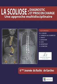 La scoliose : diagnostic et prise en charge