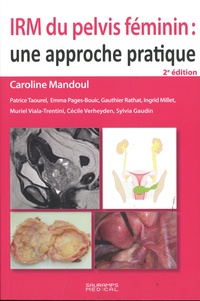 Caroline Mandoul - IRM du pelvis féminin : une approche pratique.