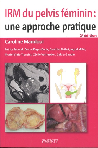 IRM du pelvis féminin : une approche pratique 2e édition