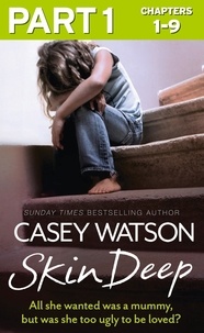 Casey Watson - Skin Deep: Part 1 of 3 - All she wanted was a mummy, but was she too ugly to be loved?.