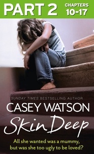 Casey Watson - Skin Deep: Part 2 of 3 - All she wanted was a mummy, but was she too ugly to be loved?.