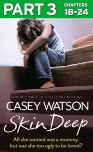 Casey Watson - Skin Deep: Part 3 of 3 - All she wanted was a mummy, but was she too ugly to be loved?.
