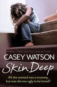 Casey Watson - Skin Deep - All She Wanted Was a Mummy, But Was She Too Ugly to Be Loved?.