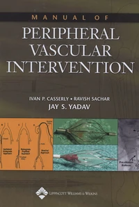 Manual of peripheral vascular Intervention
