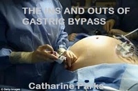  Catharine LJ Parks - The Ins and Outs of Gastric Bypass.