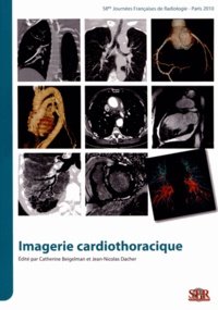 Catherine Beigelman et Jean-Nicolas Dacher - Imagerie cardiothoracique - 58e Journées françaises de radiologie, Paris 2010. 1 Cédérom