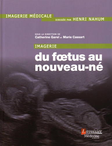 Catherine Garel et Marie Cassart - Imagerie du foetus au nouveau-né.