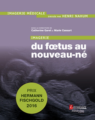 Catherine Garel et Marie Cassart - Imagerie du foetus au nouveau-né.