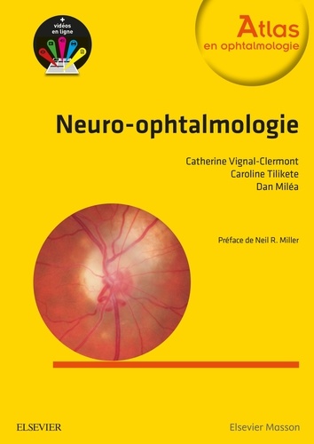 Catherine Vignal-Clermont et Caroline Tilikete - Neuro-ophtalmologie.