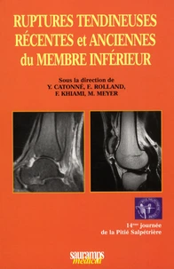 Ruptures tendineuses récentes et anciennes du membre inférieur