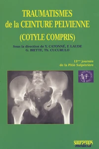 Traumatismes de la ceinture pelvienne (Cotyle compris )