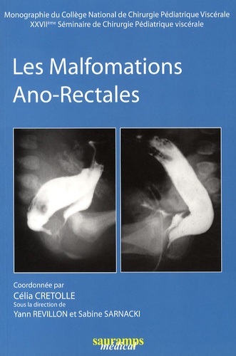 Célia Crétolle et Yann Revillon - Les malformations Ano-Rectales - 27e séminaire de chirurgie pédiatrique viscérale.