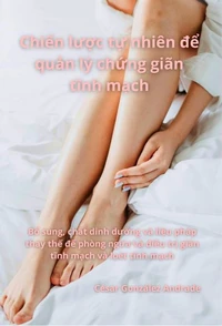 Chiến lược tự nhiên để quản lý chứng giãn tĩnh mạch