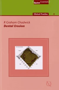Dental Erosion