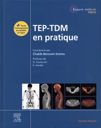 TEP-TDM en pratique