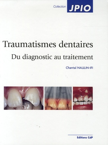 Chantal Naulin-Ifi - Traumatismes dentaires - Du diagnostic au traitement.