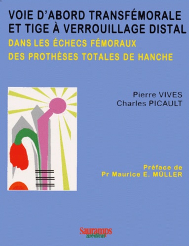 Charles Picault et Pierre Vives - Voie d'abord transfémorale et tige à verrouillage distal dans les échecs fémoraux des prothèses totales de hanche.