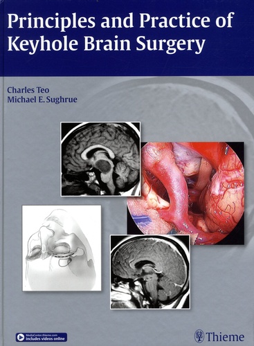 Charles Teo et Michael Sughrue - Principles and Practice of Keyhole Brain Surgery.