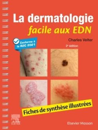 La dermatologie facile aux EDN. Fiches de synthèse illustrées 2e édition