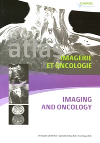 Atlas d'imagerie et oncologie