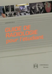 Guide de radiologie pour l'étudiant ; Urgences abdomen et pelvis