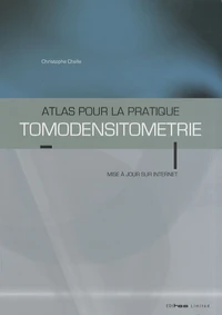 Tomodensitométrie