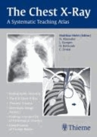 Chest X-ray Trainer - A Systematic Teaching Atlas.