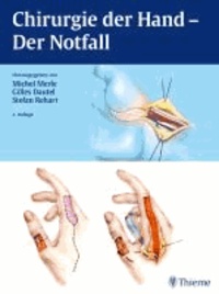 Chirurgie der Hand - Der Notfall.