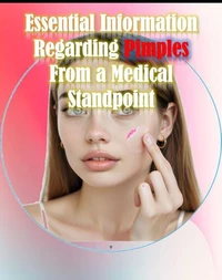 Essential information regarding pimples from a medical standpoint