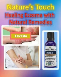 Nature’s Touch Healing Eczema with Natural Remedies