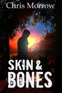 Skin &amp; Bones