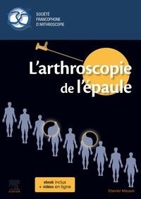 Christel Conso - L'arthroscopie de l'épaule.