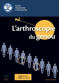 Christel Conso - L'arthroscopie du genou.