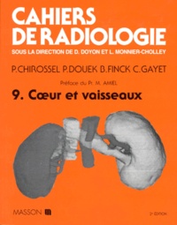 Christian Gayet et Pierre Chirossel - Cahiers de radiologie Tome 9 - Coeur et vaisseaux.