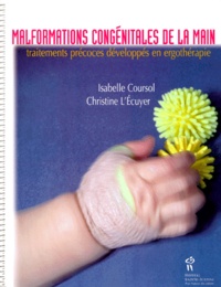 MALFORMATIONS CONGENITALES DE LA MAIN. Traitements précoces développés en ergothérapie.pdf