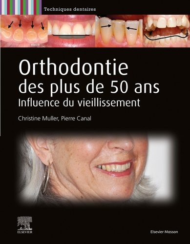 Christine Muller et Pierre Canal - Orthodontie des plus de 50 ans - Influence du vieillissement.