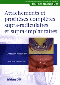 Christophe Rignon-Bret - Attachements et prothèses complètes supra-radiculaires et supra-implantaires.