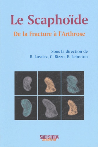Christophe Rizzo et Bruno Lussiez - Le scaphoïde - De la Fracture à l'Arthrose.