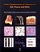 WHO Classification of Tumours of Soft Tissue and Bone