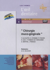 Gérard Baudoin - Chirurgie muco-gingivale. 1 DVD