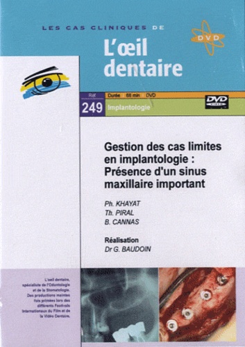 Philippe Khayat et Thierry Piral - Gestion des cas limites en implantologie : Présence d'un sinus maxillaire important. 1 DVD