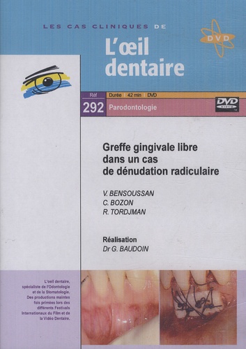 Gérard Baudoin - Greffe gingivale libre dans un cas de dénudation radiculaire. 1 DVD
