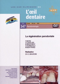 Gérard Baudoin - La régénération parodontale. 1 DVD