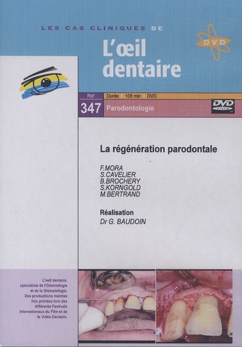 Gérard Baudoin - La régénération parodontale. 1 DVD