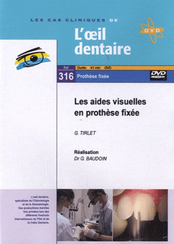 G Tirlet et Gérard Baudoin - Les aides visuelles en prothése fixée. 1 DVD