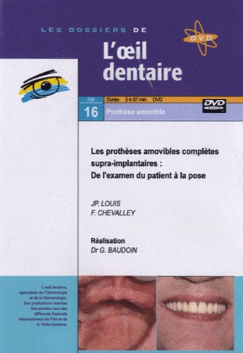 Jean-Paul Louis et F Chevalley - Les prothèses amovibles complètes supra-implantaires : de l'examen du patient à la pose. 1 DVD