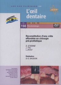 Gérard Baudoin - Reconstitution d'une crête effondrée en chirurgie pré-prothétique. 1 DVD