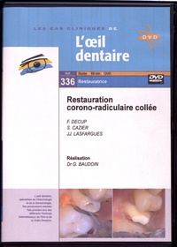 Franck Decup et Stéphane Cazier - Restauration corono-radiculaire collée. 1 DVD