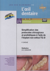Gérard Baudoin - Simplification des protocoles chirurgicaux et prothétiques à l'aide de l'implant non enfoui TG-3I. 1 DVD