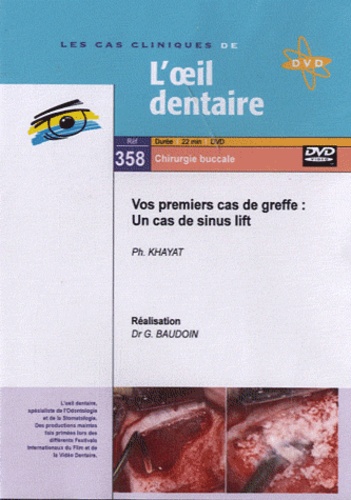 Philippe Khayat et Gérard Baudoin - Vos premiers cas de greffe : un cas de sinus lift. 1 DVD